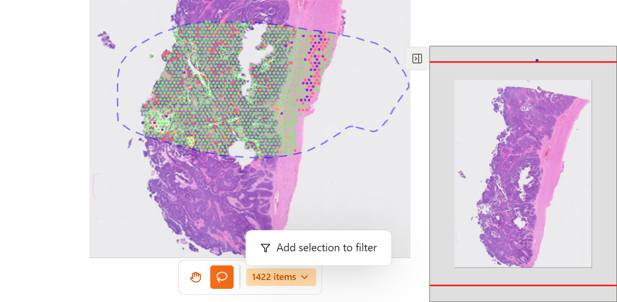 Lasso condition example